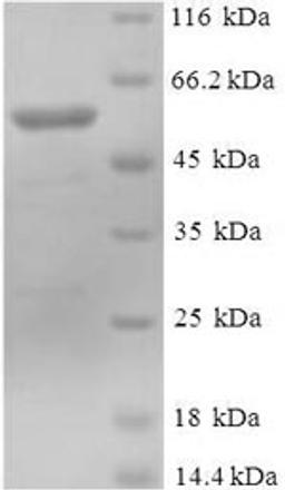 (Tris-Glycine gel) Discontinuous SDS-PAGE (reduced) with 5% enrichment gel and 15% separation gel.