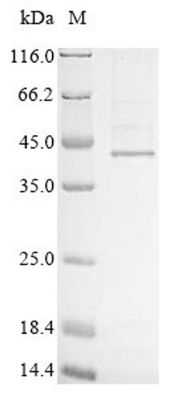 (Tris-Glycine gel) Discontinuous SDS-PAGE (reduced) with 5% enrichment gel and 15% separation gel.