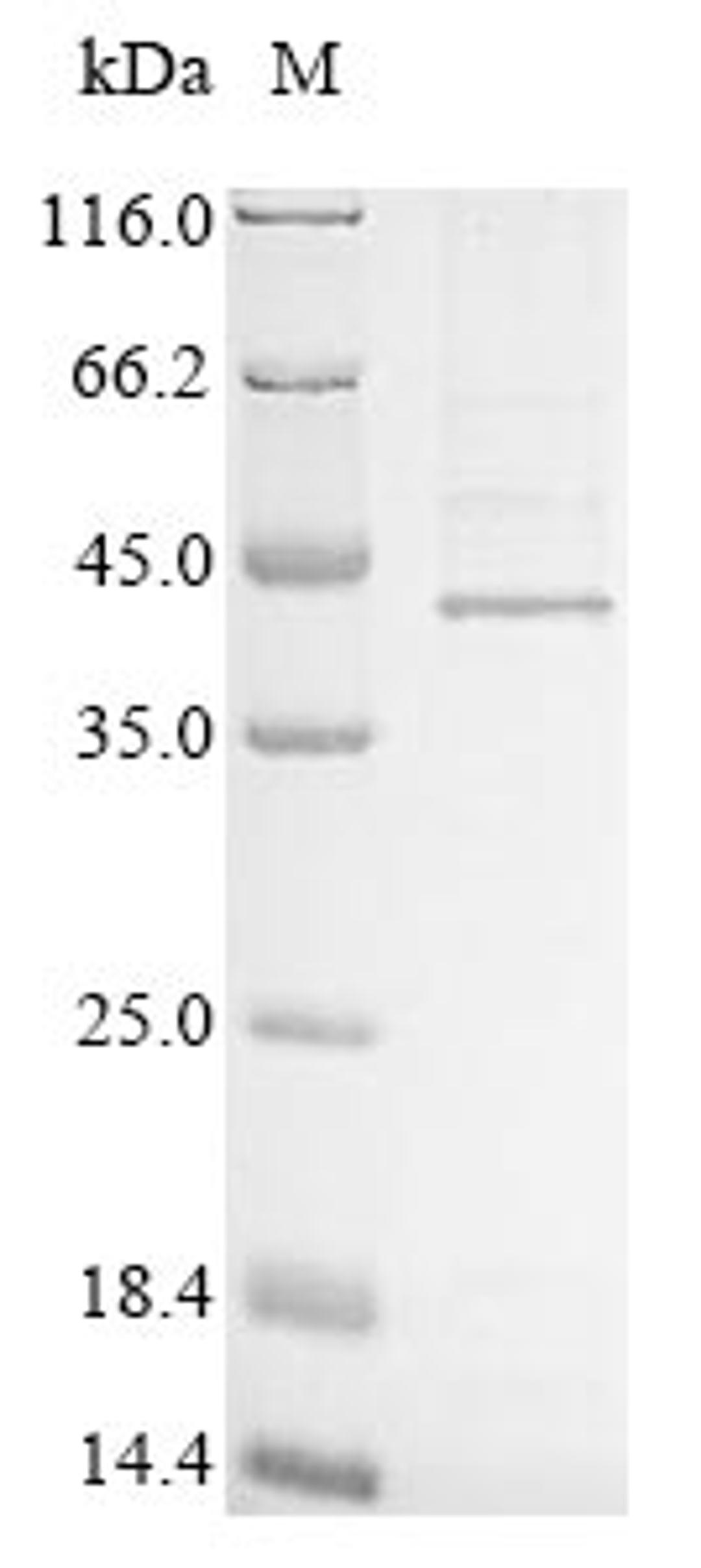 (Tris-Glycine gel) Discontinuous SDS-PAGE (reduced) with 5% enrichment gel and 15% separation gel.