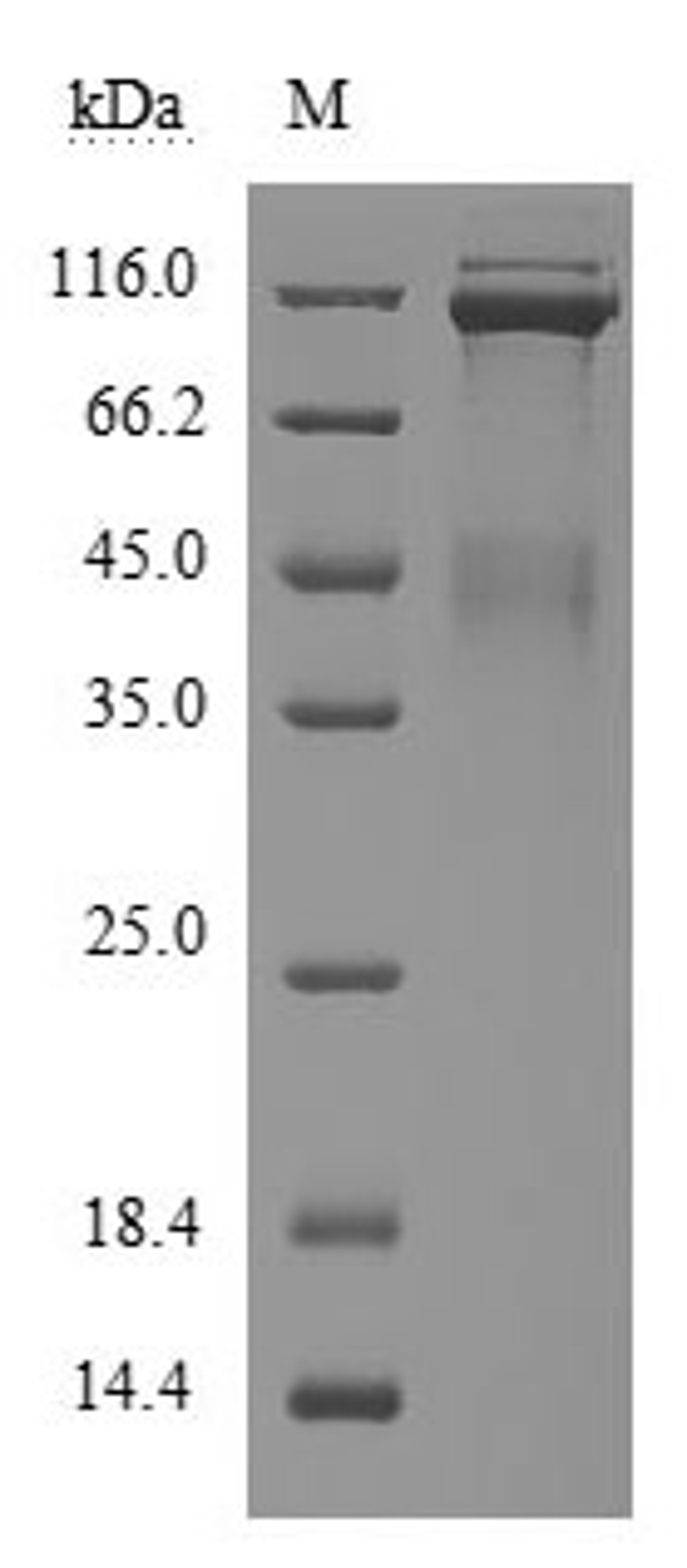 (Tris-Glycine gel) Discontinuous SDS-PAGE (reduced) with 5% enrichment gel and 15% separation gel.