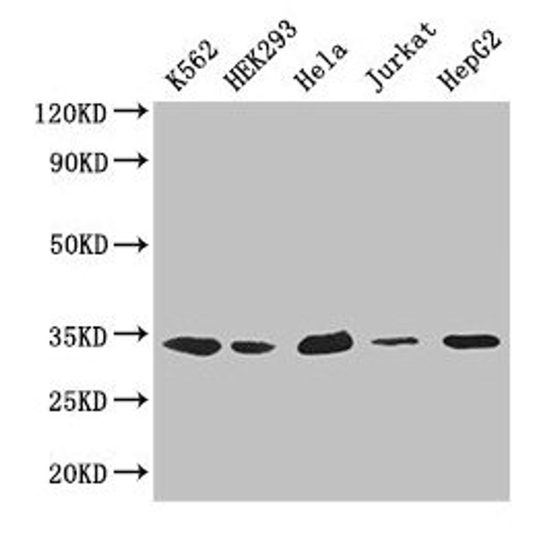 Western Blot. Positive WB detected in: K562 whole cell lysate, HEK293 whole cell lysate, Hela whole cell lysate, Jurkat whole cell lysate, HepG2 whole cell lysate. All lanes: CDK2 antibody at 2.6µg/ml. Secondary. Goat polyclonal to rabbit IgG at 1/50000 dilution. Predicted band size: 34, 31 kDa. Observed band size: 34 kDa