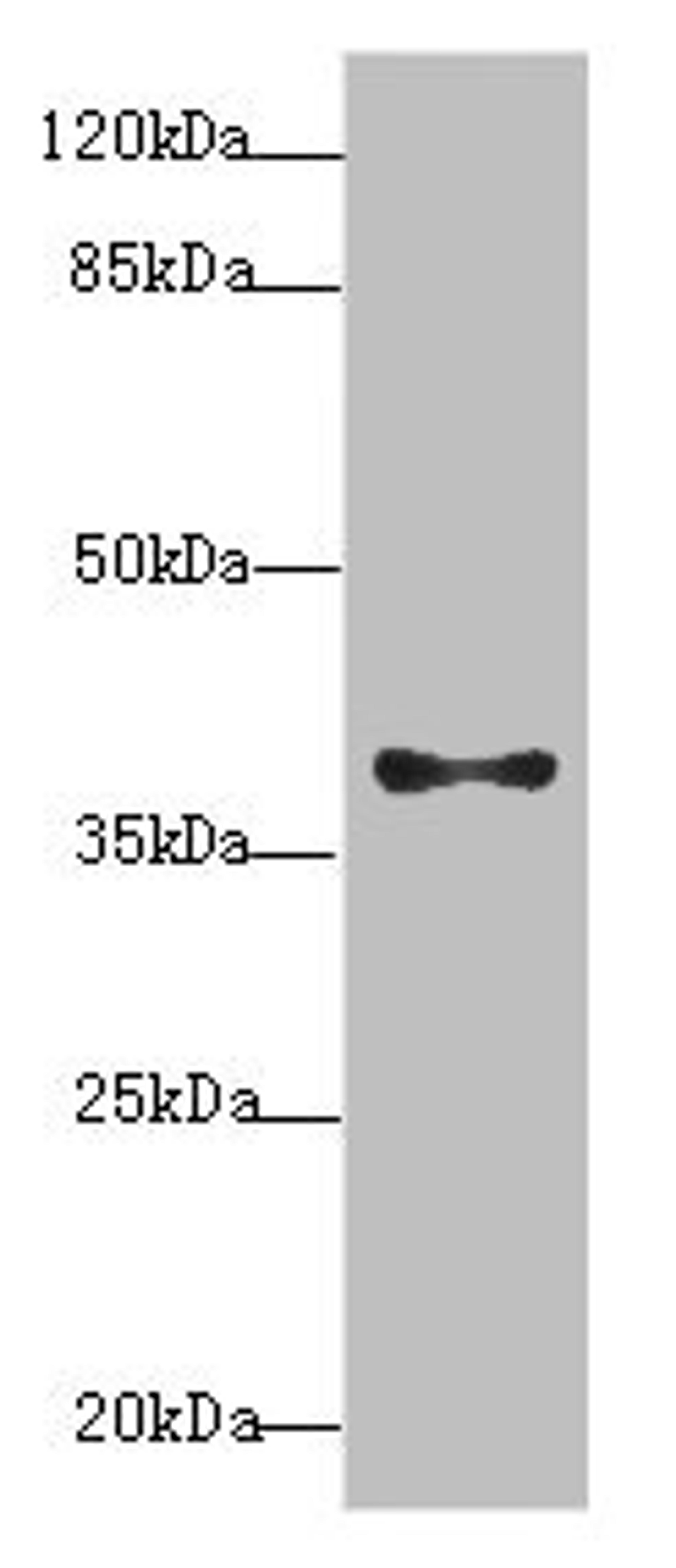 Western blot. All lanes: PDCD2L antibody at 1.4µg/ml + MCF-7 whole cell lysate. Secondary. Goat polyclonal to rabbit IgG at 1/10000 dilution. Predicted band size: 39 kDa. Observed band size: 39 kDa