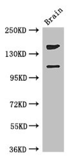 Western Blot. Positive WB detected in: Mouse brain tissue. All lanes: PREX2 antibody at 3.4ug/ml. Secondary. Goat polyclonal to rabbit IgG at 1/50000 dilution. Predicted band size: 183, 172, 113 kDa. Observed band size: 183, 113 kDa. 