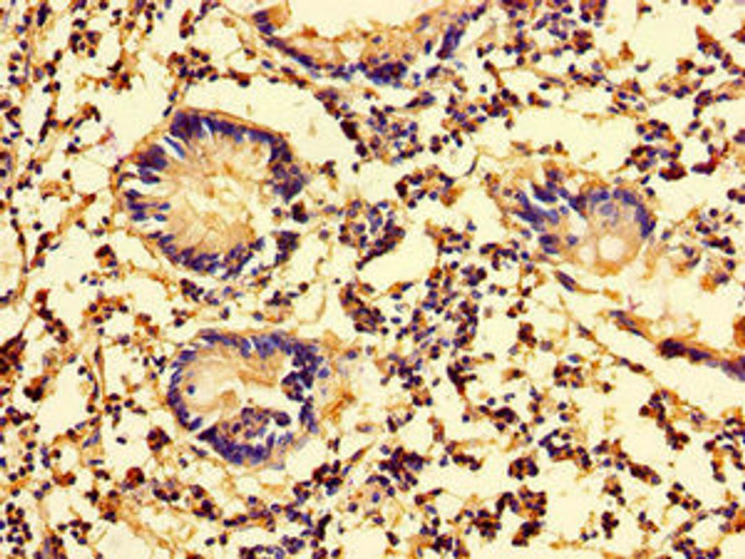 Immunohistochemistry of paraffin-embedded human appendix tissue using CSB-PA013240LA01HU at dilution of 1:100