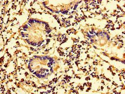 Immunohistochemistry of paraffin-embedded human appendix tissue using CSB-PA013240LA01HU at dilution of 1:100