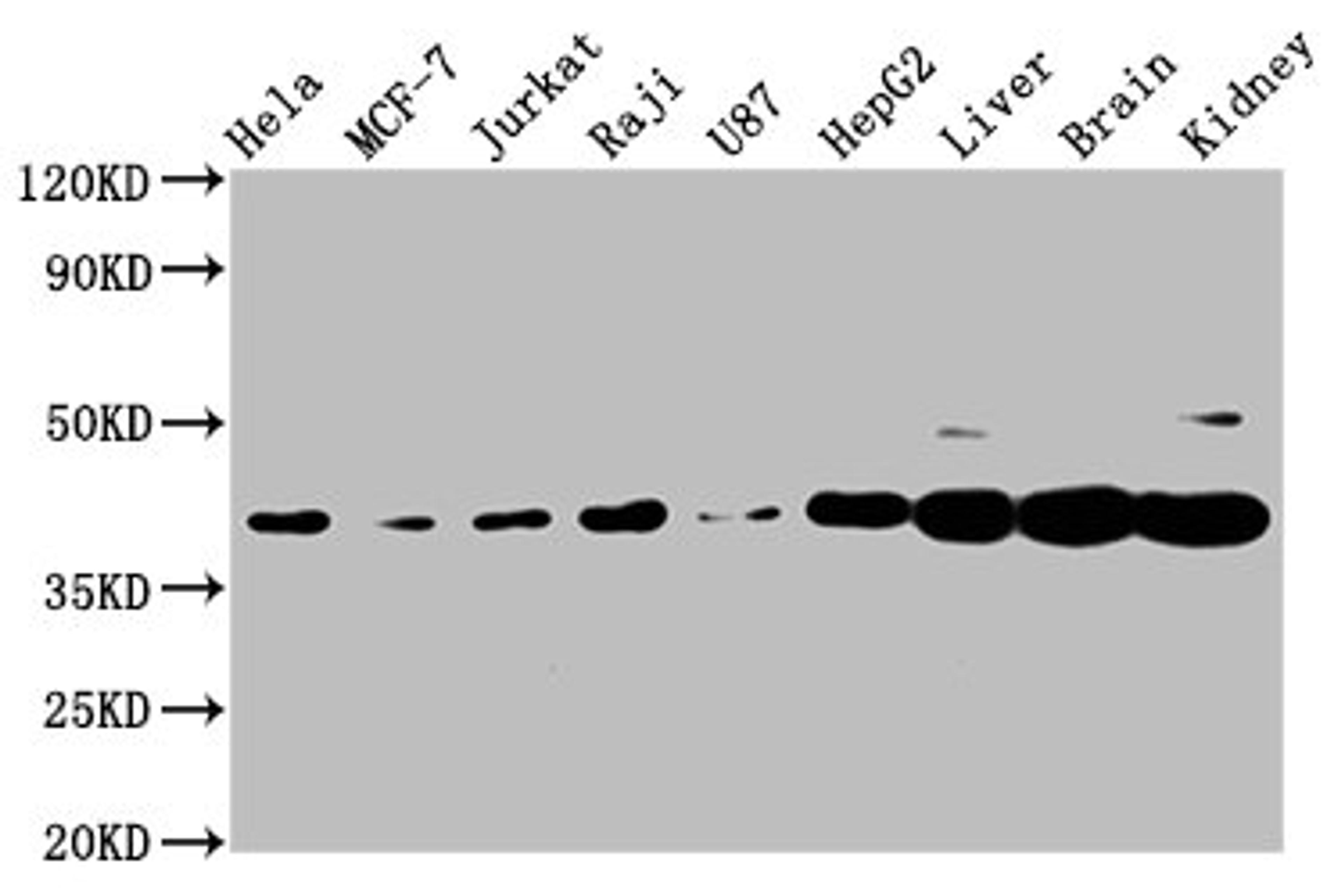 Western Blot. Positive WB detected in: Hela whole cell lysate, MCF-7 whole cell lysate, Jurkat whole cell lysate, Raji whole cell lysate, U87 whole cell lysate, HepG2 whole cell lysate, Rat liver tissue, Mouse brain tissue, Mouse kidney tissue. All lanes: PNCK antibody at 3.1µg/ml. Secondary. Goat polyclonal to rabbit IgG at 1/50000 dilution. Predicted band size: 39, 41, 28, 47 kDa. Observed band size: 39 kDa