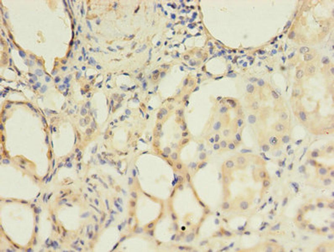 Immunohistochemistry of paraffin-embedded human kidney tissue using CSB-PA002748LA01HU at dilution of 1:100