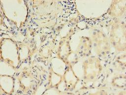 Immunohistochemistry of paraffin-embedded human kidney tissue using CSB-PA002748LA01HU at dilution of 1:100