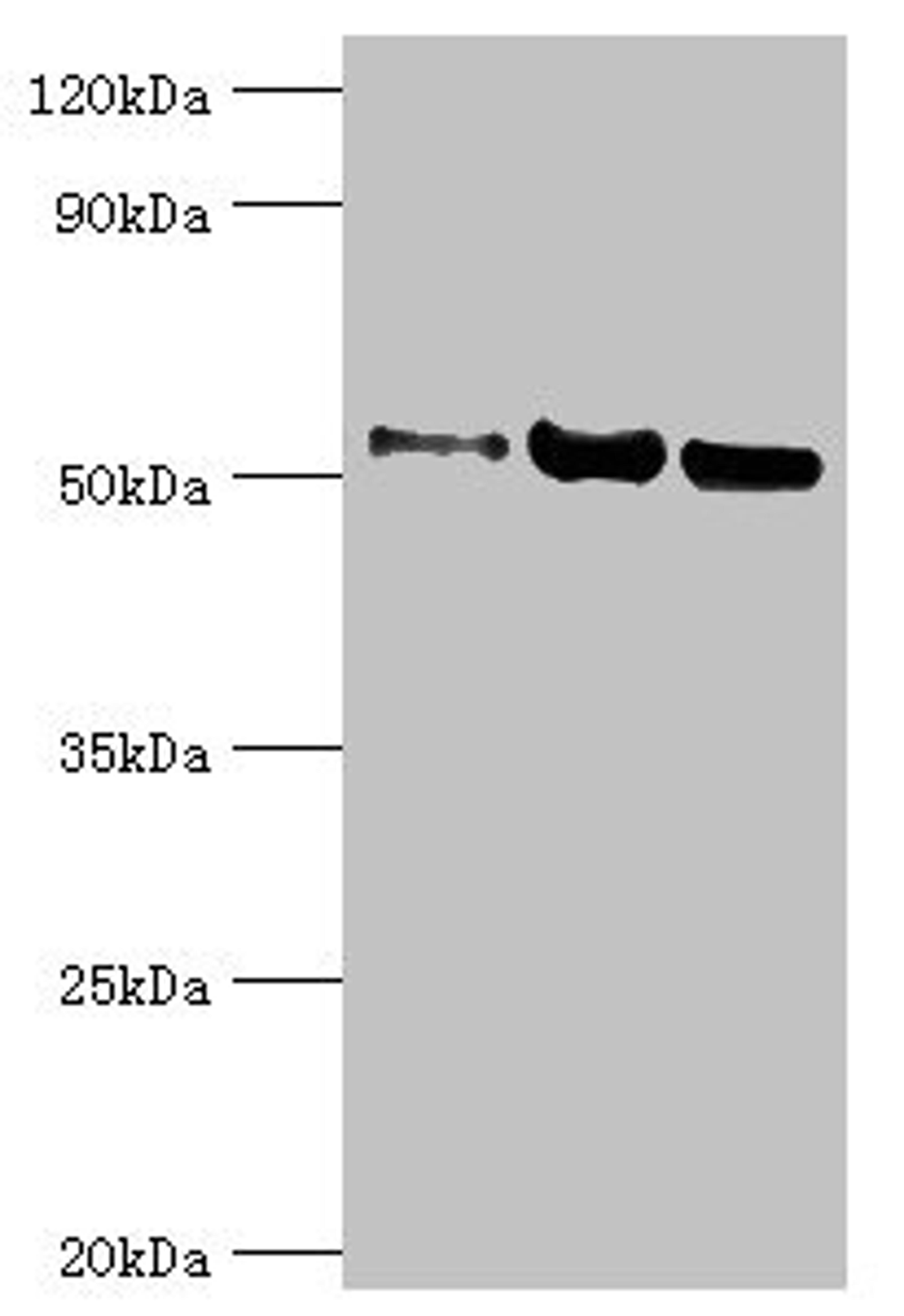 Western blot. All lanes: Carbonic anhydrase 1 antibody at 2ug/ml. Lane 1: HepG2 whole cell lysate. Lane 2: 293T whole cell lysate. Lane 3: 293T whole cell lysate. Secondary. Goat polyclonal to rabbit IgG at 1/10000 dilution. Predicted band size: 53, 14 kDa. Observed band size: 53 kDa. 