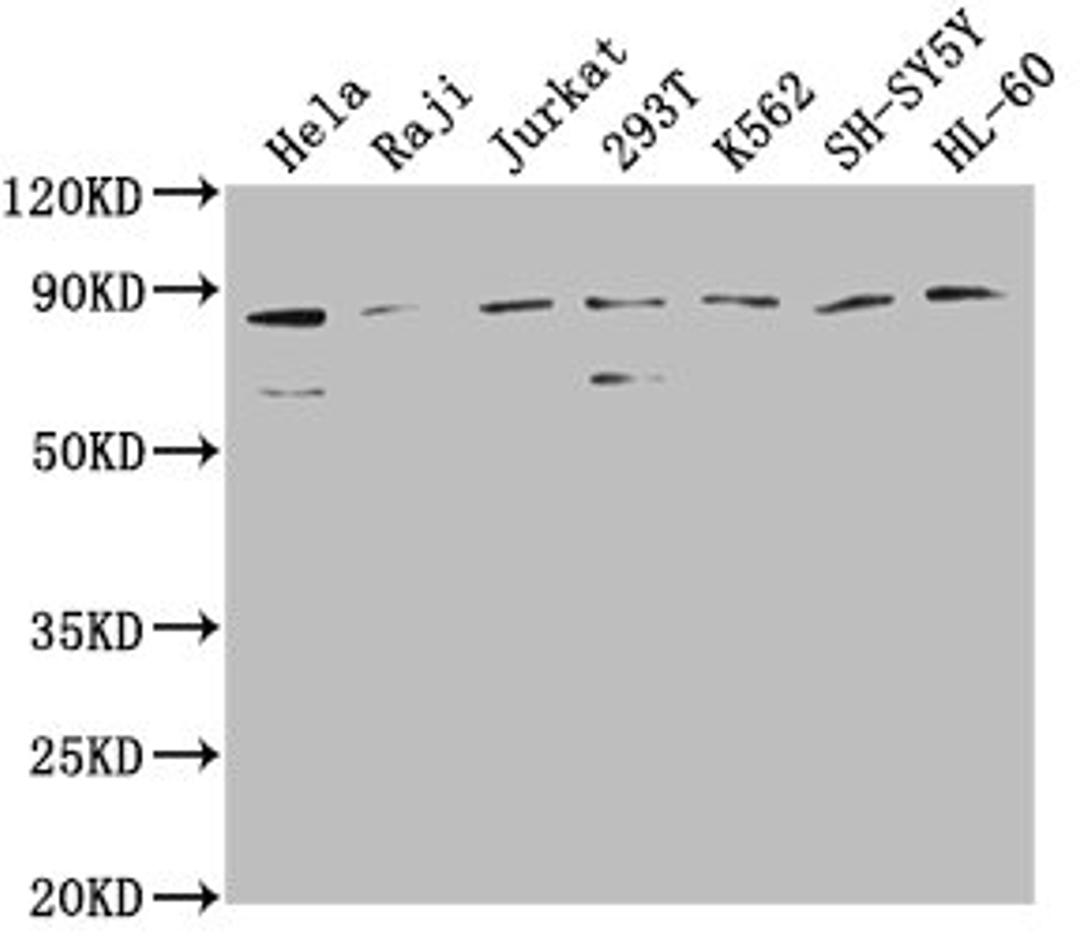 Western Blot. Positive WB detected in: Hela whole cell lysate, Raji whole cell lysate, Jurkat whole cell lysate, 293T whole cell lysate, K562 whole cell lysate, SH-SY5Y whole cell lysate, HL-60 whole cell lysate. All lanes: ZRANB1 antibody at 1:2000. Secondary. Goat polyclonal to rabbit IgG at 1/50000 dilution. Predicted band size: 81 kDa. Observed band size: 81 kDa. 