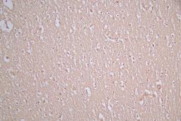IHC image of CSB-RA021912MA1HU diluted at 1:100 and staining in paraffin-embedded human brain tissue performed on a Leica BondTM system. After dewaxing and hydration, antigen retrieval was mediated by high pressure in a citrate buffer (pH 6.0). Section was blocked with 10% normal goat serum 30min at RT. Then primary antibody (1% BSA) was incubated at 4°C overnight. The primary is detected by a Goat anti-Mouse IgG labeled by HRP and visualized using 0.05% DAB.