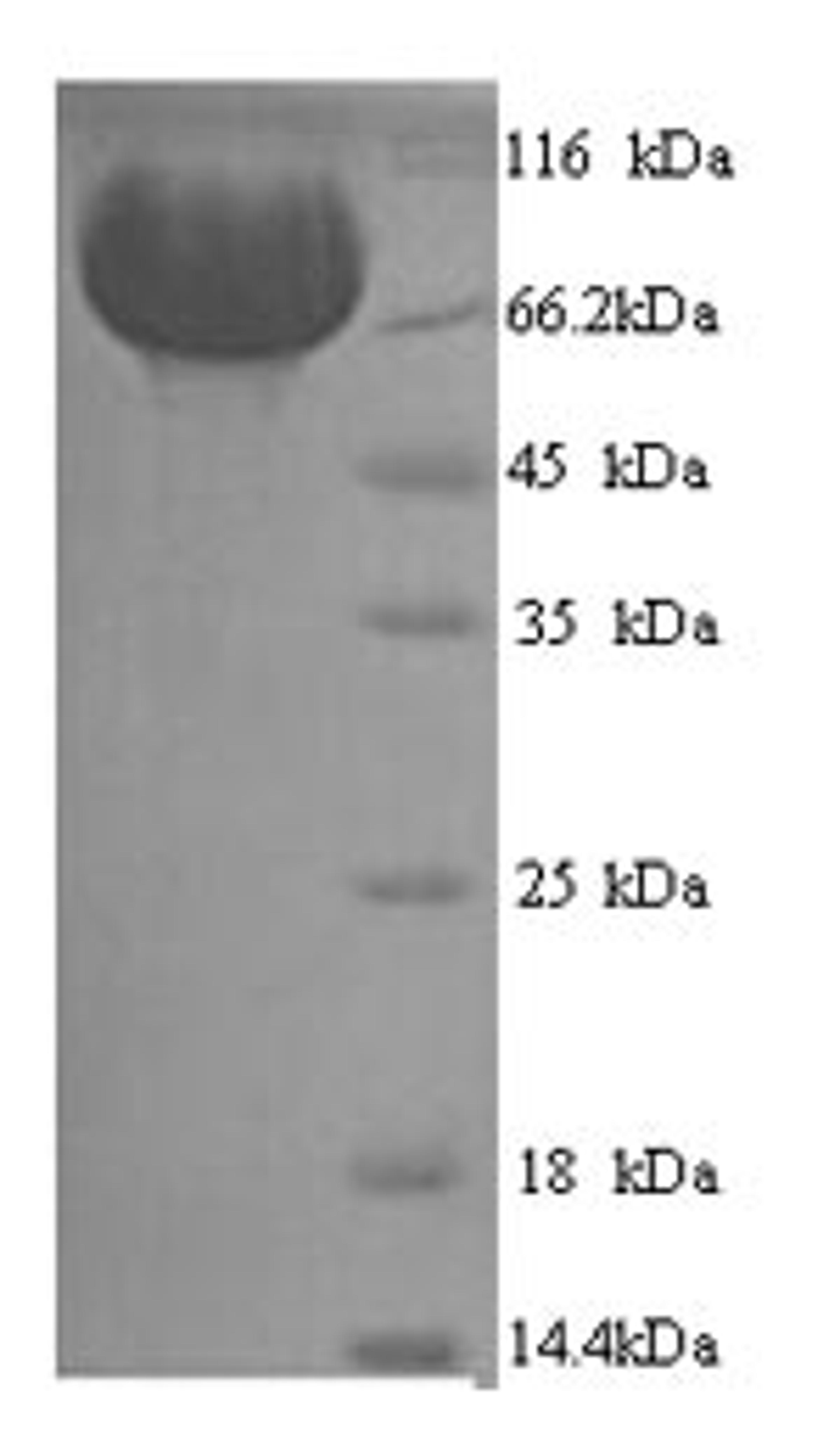(Tris-Glycine gel) Discontinuous SDS-PAGE (reduced) with 5% enrichment gel and 15% separation gel.