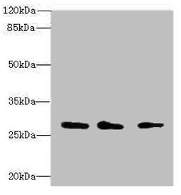 Western blot. All lanes: CAPNS1 antibody at 1.15µg/ml. Lane 1: Mouse lung tissue. Lane 2: Mouse brain tissue. Lane 3: Hela whole cell lysate. Secondary. Goat polyclonal to rabbit IgG at 1/10000 dilution. Predicted band size: 28 kDa. Observed band size: 28 kDa