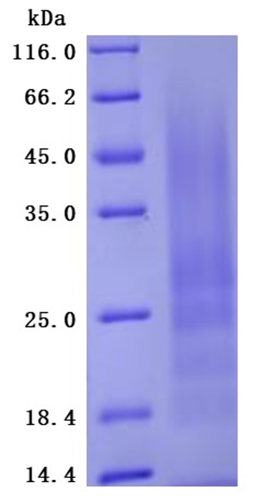 (Tris-Glycine gel) Discontinuous SDS-PAGE (reduced) with 5% enrichment gel and 15% separation gel.