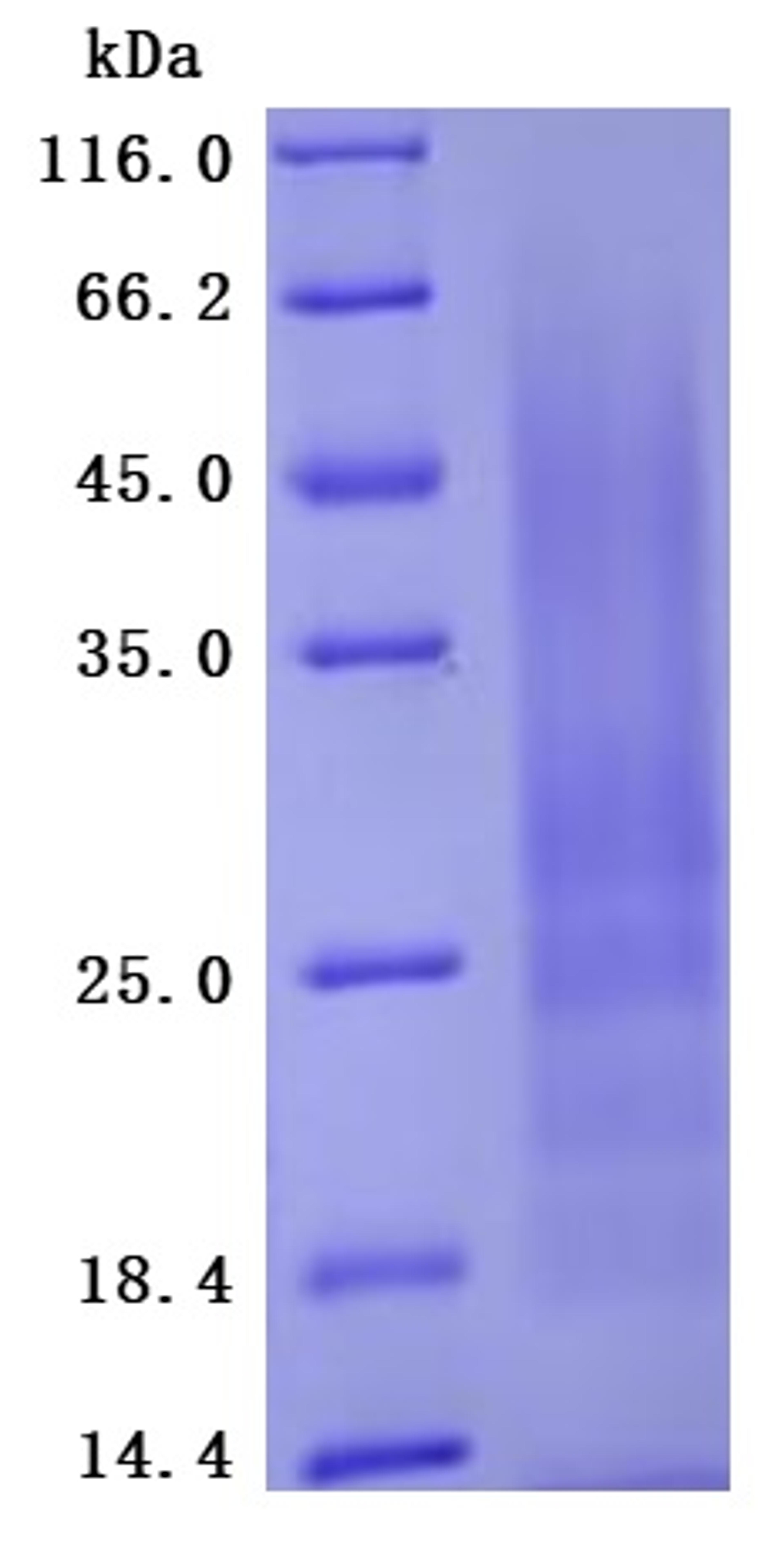 (Tris-Glycine gel) Discontinuous SDS-PAGE (reduced) with 5% enrichment gel and 15% separation gel.