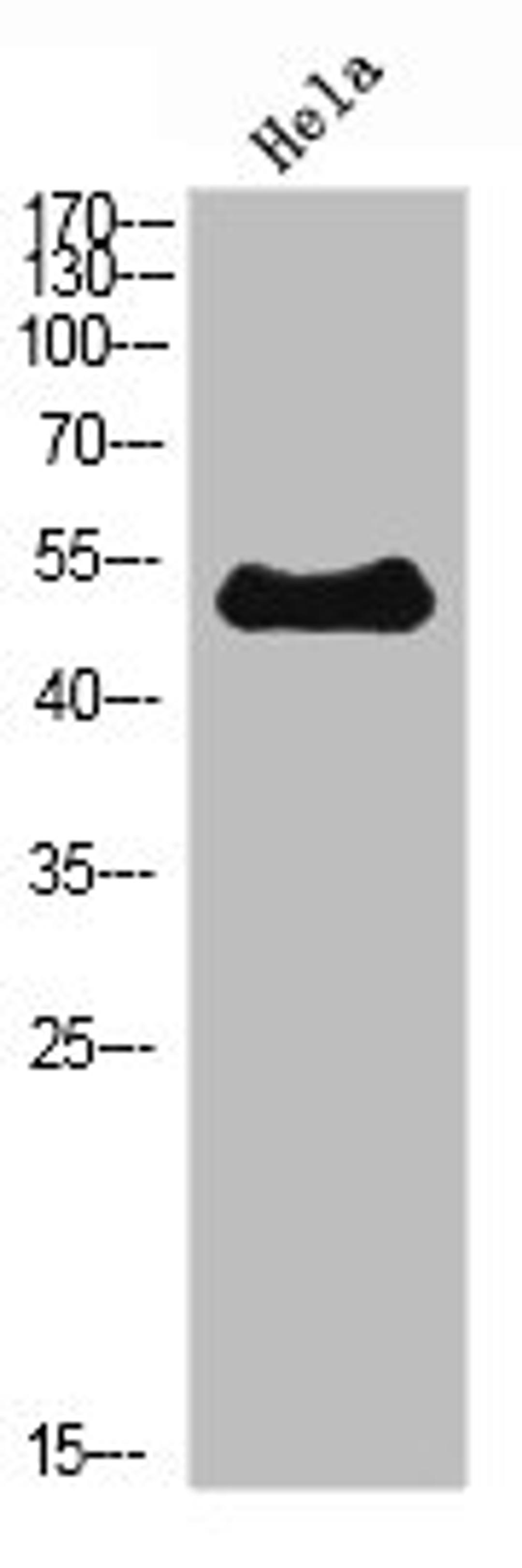 Western Blot analysis of Hela cells using ETBR Polyclonal Antibody diluted at 1:500. Secondary antibody  was diluted at 1:20000