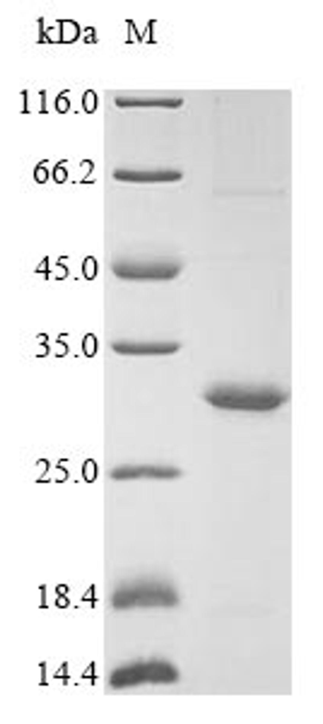 (Tris-Glycine gel) Discontinuous SDS-PAGE (reduced) with 5% enrichment gel and 15% separation gel.