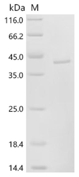 (Tris-Glycine gel) Discontinuous SDS-PAGE (reduced) with 5% enrichment gel and 15% separation gel.