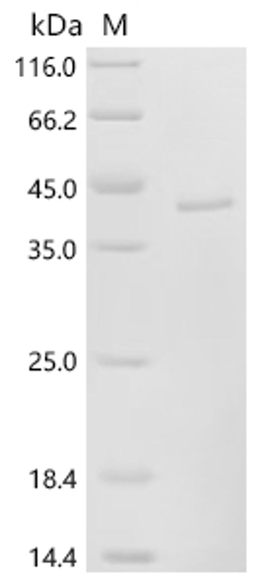 (Tris-Glycine gel) Discontinuous SDS-PAGE (reduced) with 5% enrichment gel and 15% separation gel.