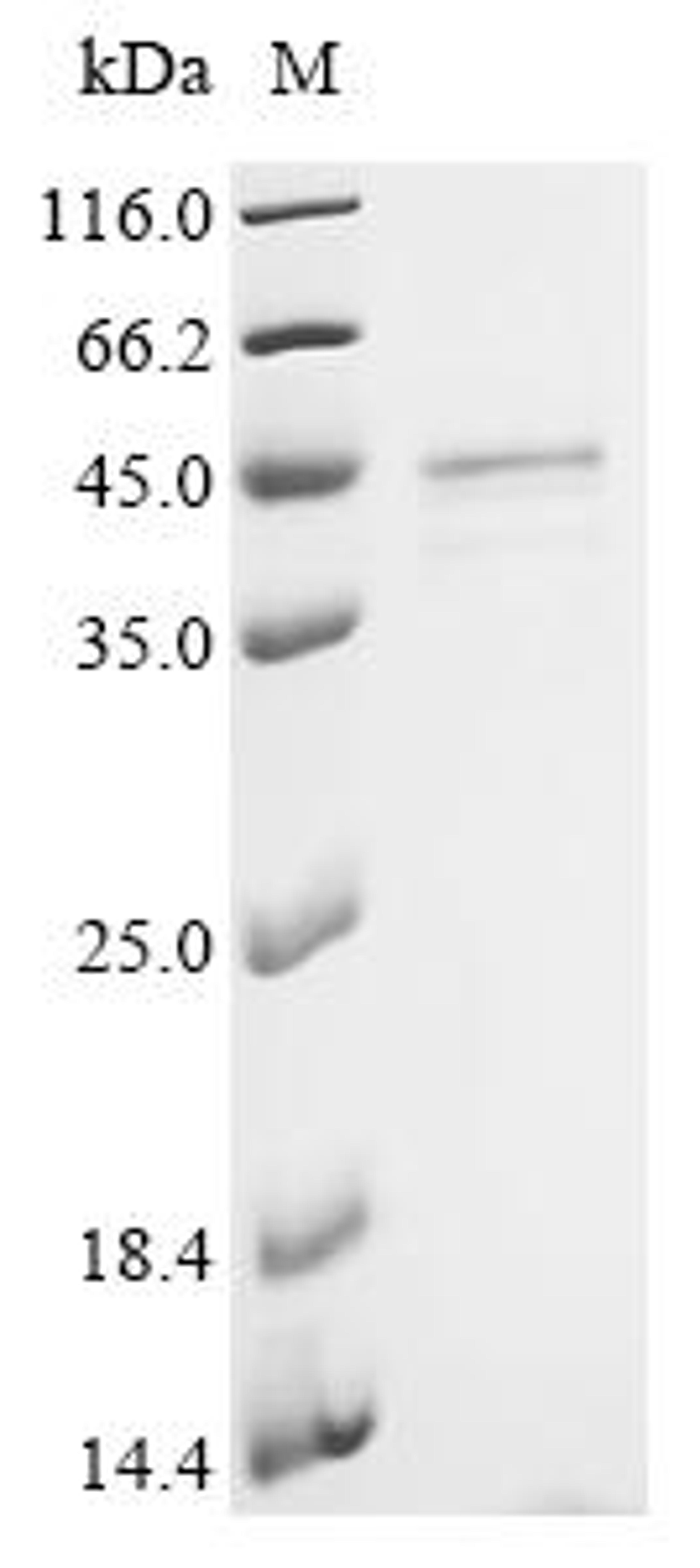 (Tris-Glycine gel) Discontinuous SDS-PAGE (reduced) with 5% enrichment gel and 15% separation gel.