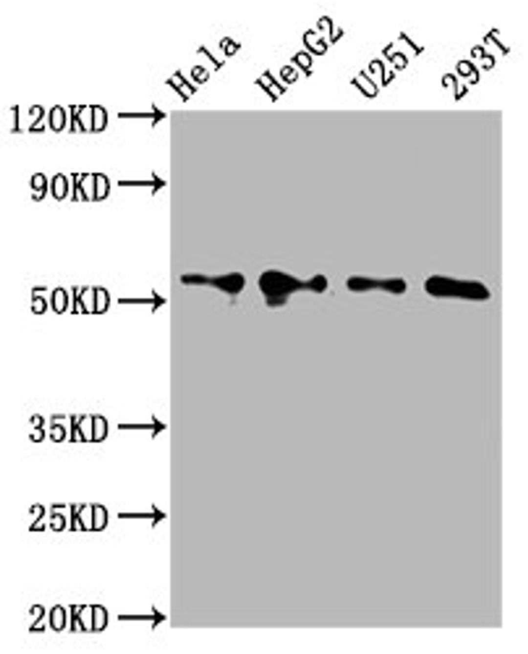 Western Blot. Positive WB detected in: Hela whole cell lysate, HepG2 whole cell lysate, U251 whole cell lysate, 293T whole cell lysate. All lanes: CCT6A antibody at 4.2µg/ml. Secondary. Goat polyclonal to rabbit IgG at 1/50000 dilution. Predicted band size: 59, 54 kDa. Observed band size: 54 kDa