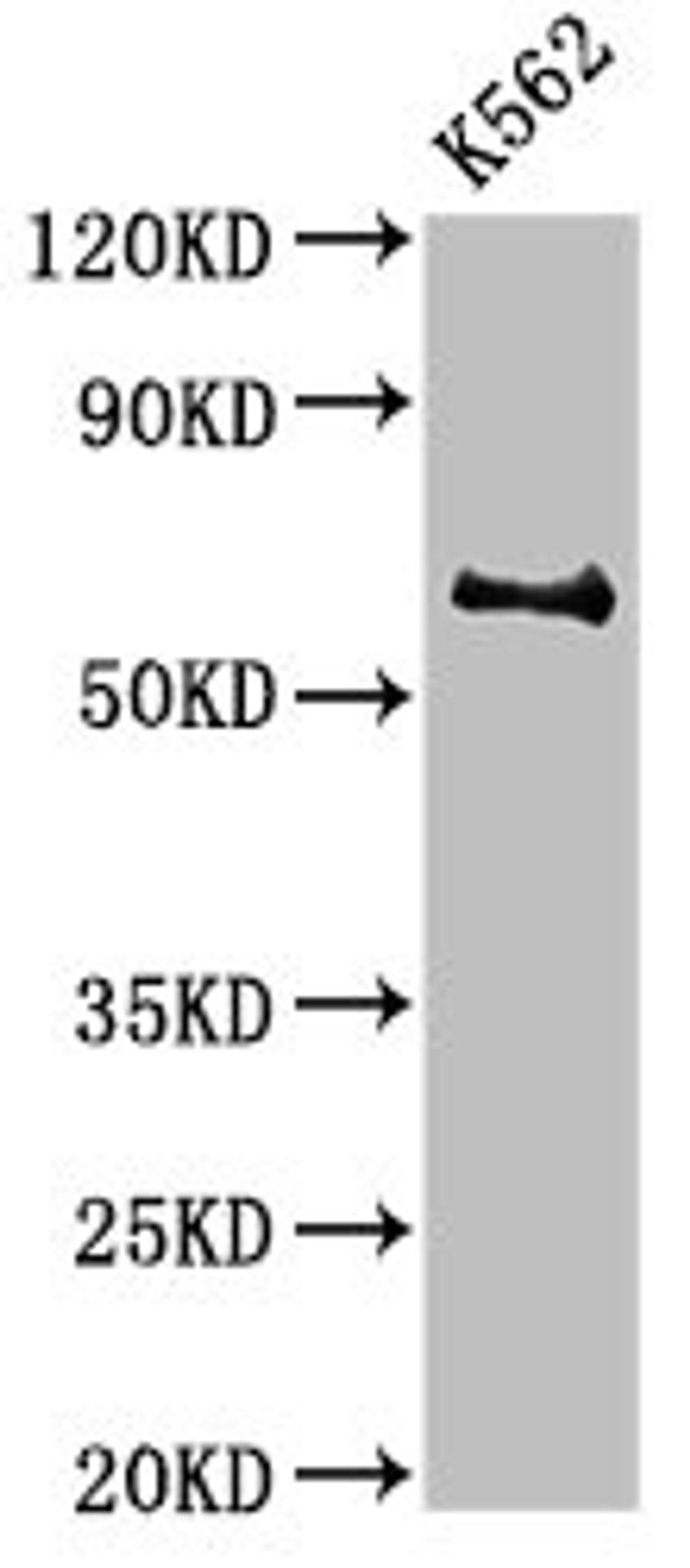 Western Blot. Positive WB detected in: K562 whole cell lysate. All lanes: BCHE antibody at 3µg/ml. Secondary. Goat polyclonal to rabbit IgG at 1/50000 dilution. Predicted band size: 69 kDa. Observed band size: 69 kDa