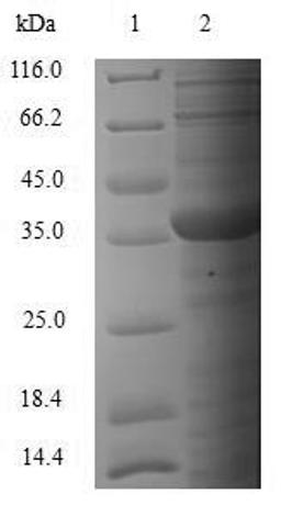 (Tris-Glycine gel) Discontinuous SDS-PAGE (reduced) with 5% enrichment gel and 15% separation gel.