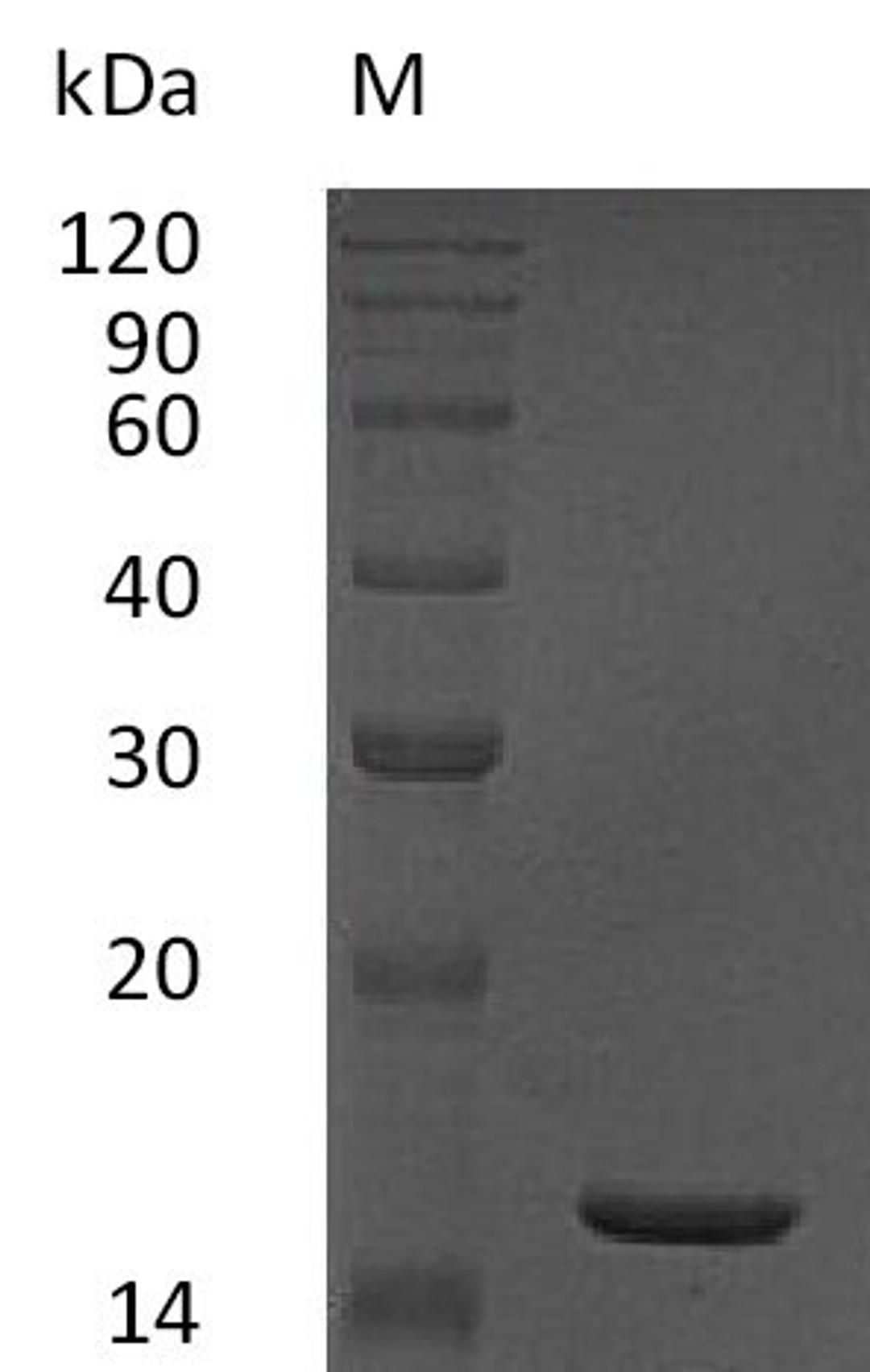 (Tris-Glycine gel) Discontinuous SDS-PAGE (reduced) with 5% enrichment gel and 15% separation gel.
