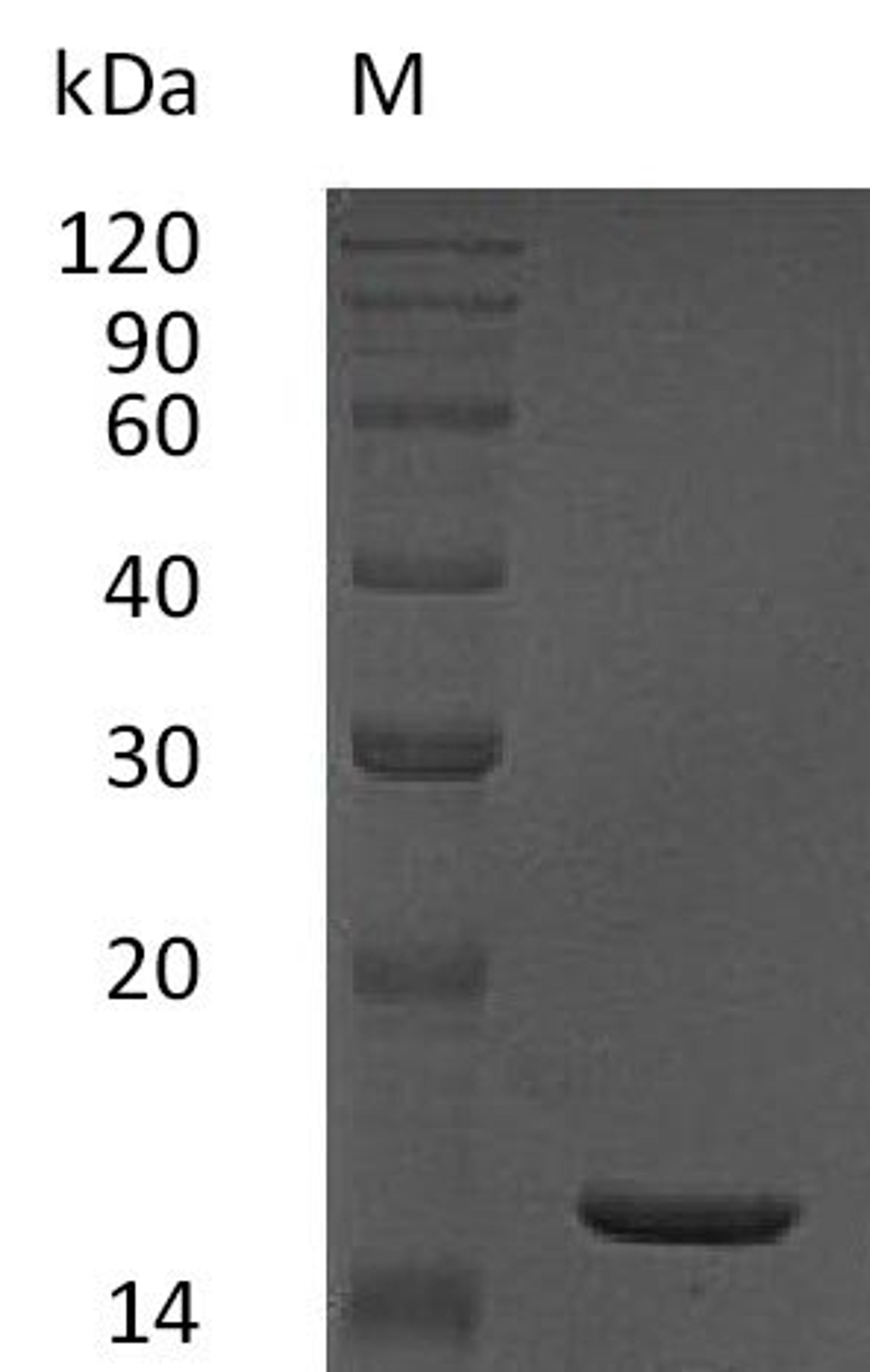 (Tris-Glycine gel) Discontinuous SDS-PAGE (reduced) with 5% enrichment gel and 15% separation gel.