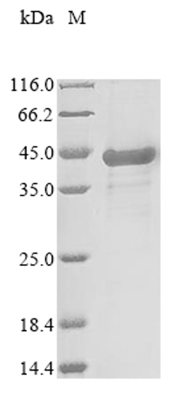 (Tris-Glycine gel) Discontinuous SDS-PAGE (reduced) with 5% enrichment gel and 15% separation gel.