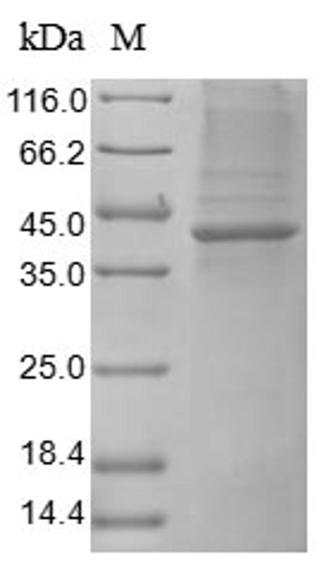(Tris-Glycine gel) Discontinuous SDS-PAGE (reduced) with 5% enrichment gel and 15% separation gel.