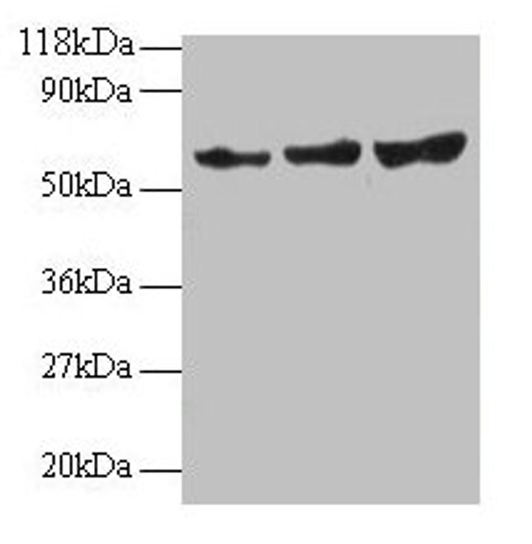 Western blot. All lanes: TIMP2 antibody at 2µg/ml. Lane 1: EC109 whole cell lysate. Lane 2: 293T whole cell lysate. Secondary. Goat polyclonal to rabbit IgG at 1/15000 dilution. Predicted band size: 25 kDa. Observed band size: 60 kDa