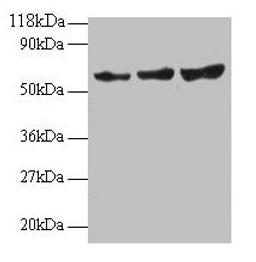 Western blot. All lanes: TIMP2 antibody at 2µg/ml. Lane 1: EC109 whole cell lysate. Lane 2: 293T whole cell lysate. Secondary. Goat polyclonal to rabbit IgG at 1/15000 dilution. Predicted band size: 25 kDa. Observed band size: 60 kDa