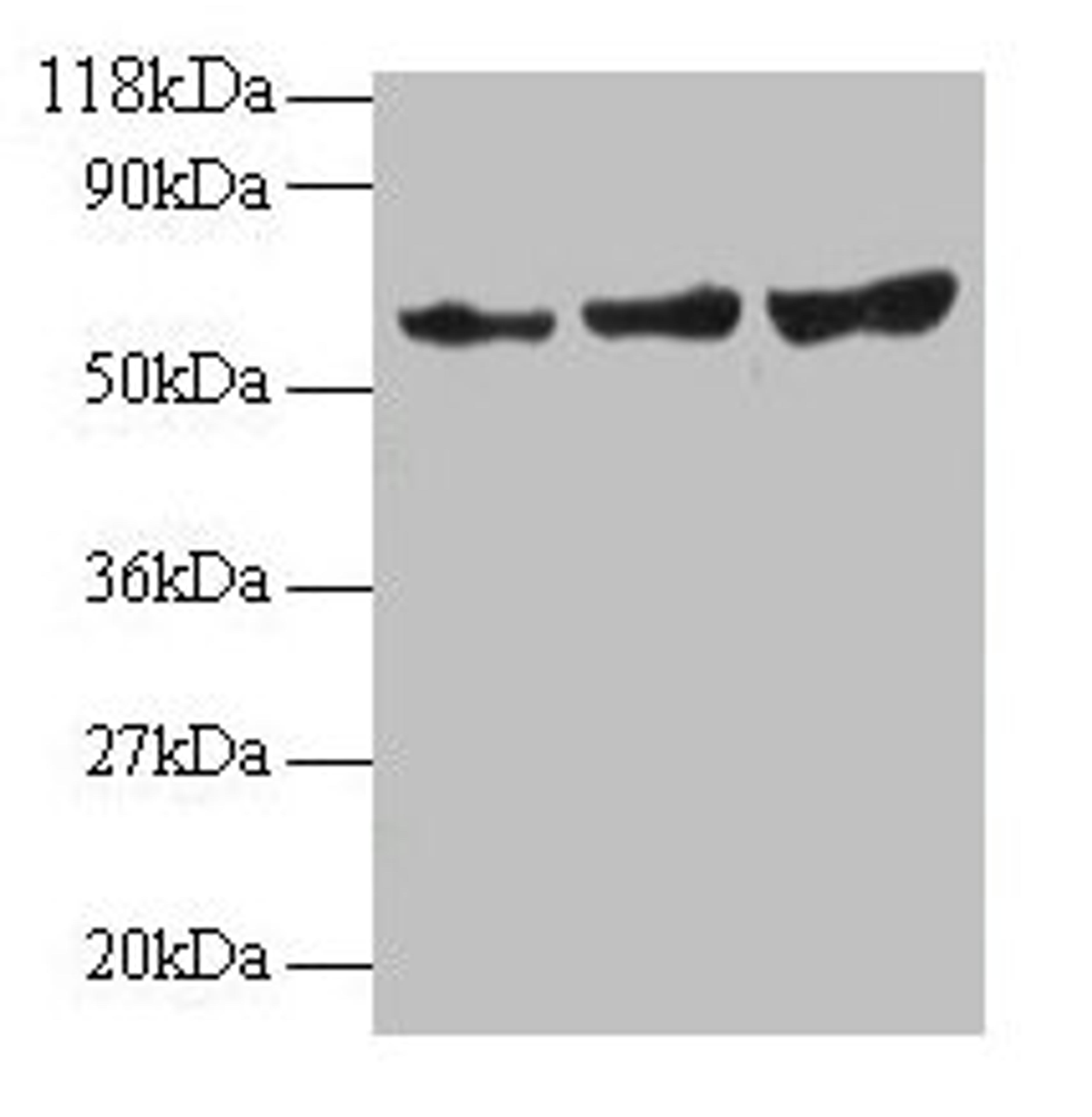 Western blot. All lanes: TIMP2 antibody at 2µg/ml. Lane 1: EC109 whole cell lysate. Lane 2: 293T whole cell lysate. Secondary. Goat polyclonal to rabbit IgG at 1/15000 dilution. Predicted band size: 25 kDa. Observed band size: 60 kDa