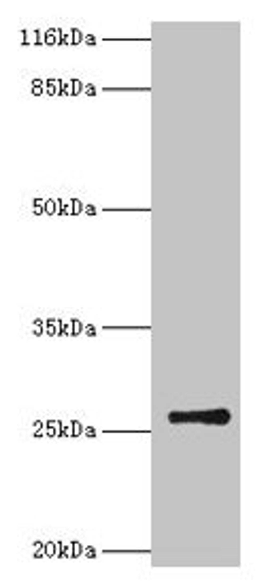 Western blot. All lanes: TK1 antibody at 2µg/ml + CEM whole cell lysate. Secondary. Goat polyclonal to rabbit IgG at 1/10000 dilution. Predicted band size: 26 kDa. Observed band size: 26 kDa