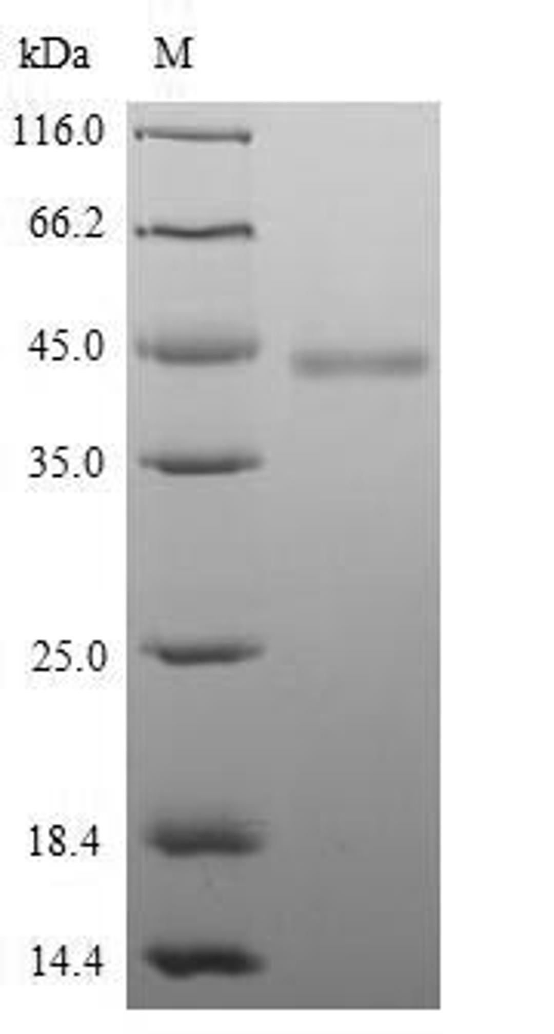 (Tris-Glycine gel) Discontinuous SDS-PAGE (reduced) with 5% enrichment gel and 15% separation gel.