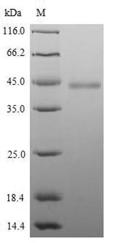 (Tris-Glycine gel) Discontinuous SDS-PAGE (reduced) with 5% enrichment gel and 15% separation gel.