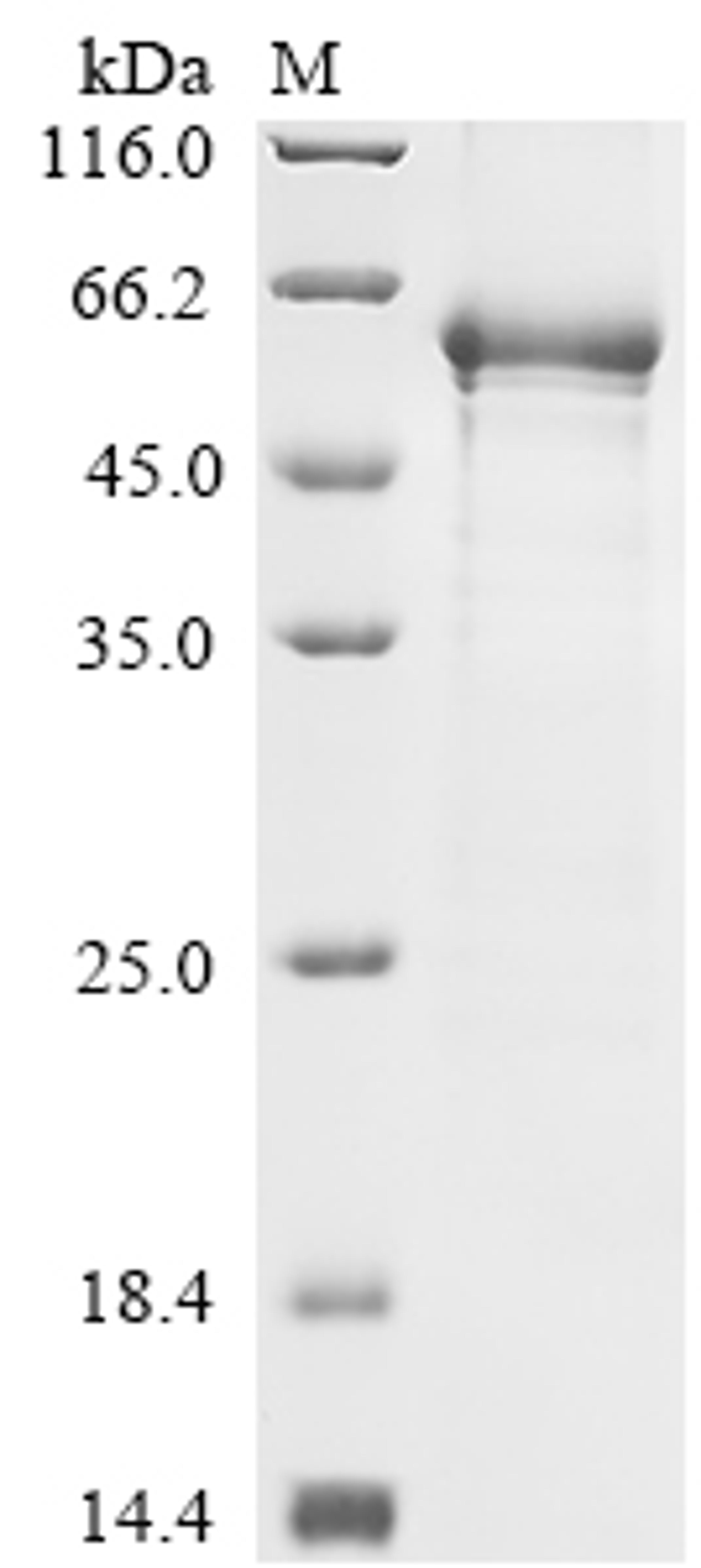 (Tris-Glycine gel) Discontinuous SDS-PAGE (reduced) with 5% enrichment gel and 15% separation gel.
