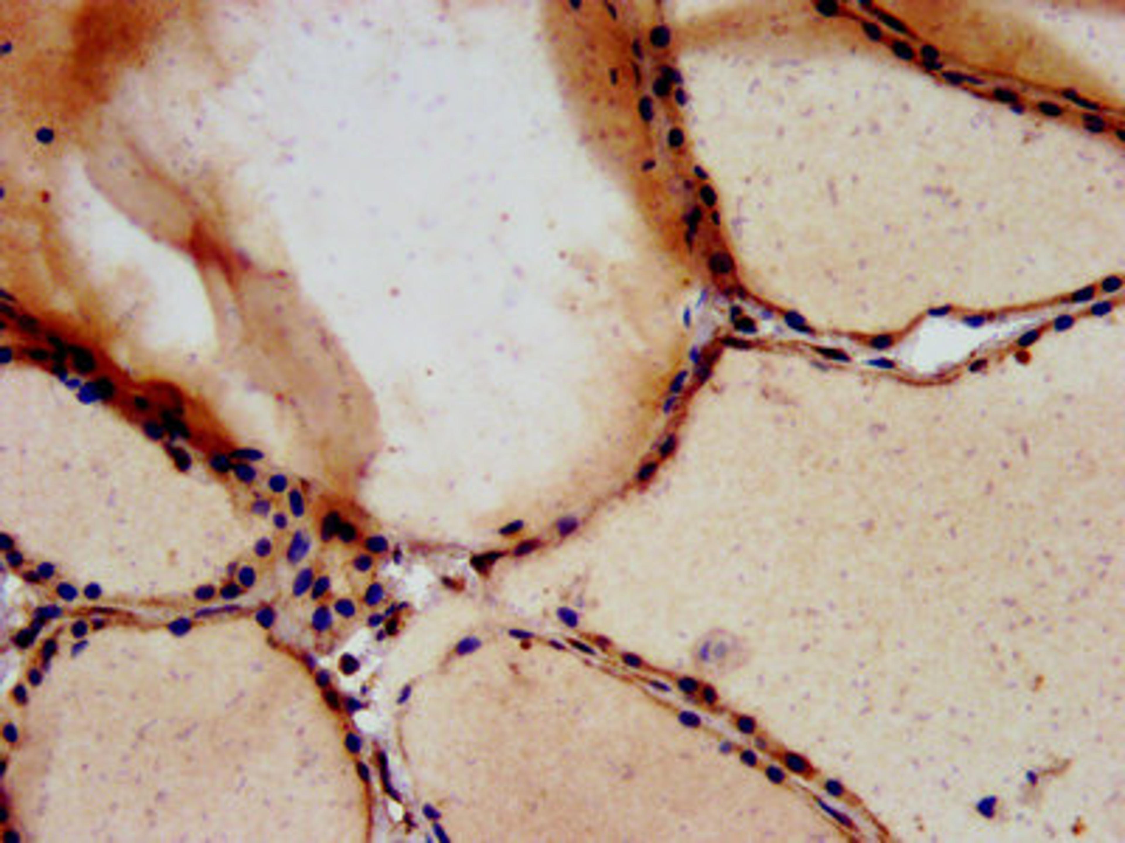 IHC image of CSB-PA025167LA01HU diluted at 1:700 and staining in paraffin-embedded human thyroid tissue performed on a Leica BondTM system. After dewaxing and hydration, antigen retrieval was mediated by high pressure in a citrate buffer (pH 6.0). Section was blocked with 10% normal goat serum 30min at RT. Then primary antibody (1% BSA) was incubated at 4&deg;C overnight. The primary is detected by a biotinylated secondary antibody and visualized using an HRP conjugated SP system.