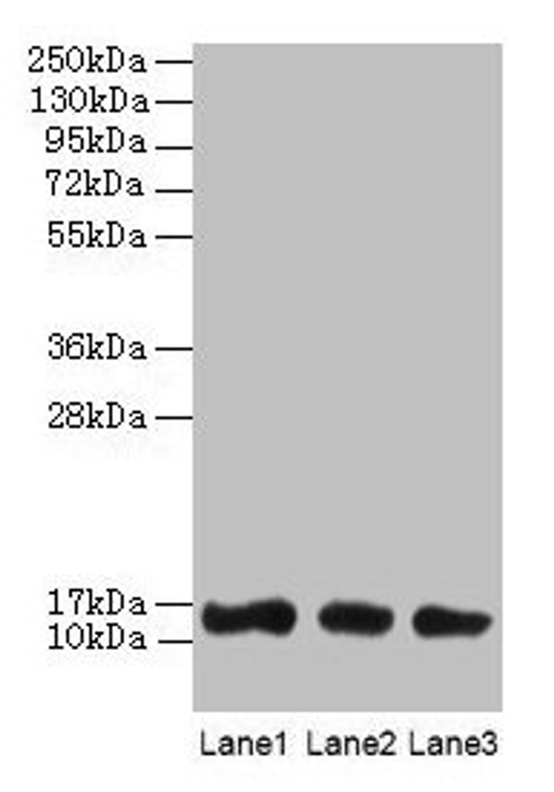 Western blot. All lanes: LGALS1 antibody at 2µg/ml. Lane 1: HL60 whole cell lysate. Lane 2: NIH/3T3 whole cell lysate. Lane 3: HepG2 whole cell lysate. Secondary. Goat polyclonal to rabbit IgG at 1/10000 dilution. Predicted band size: 15 kDa. Observed band size: 15 kDa