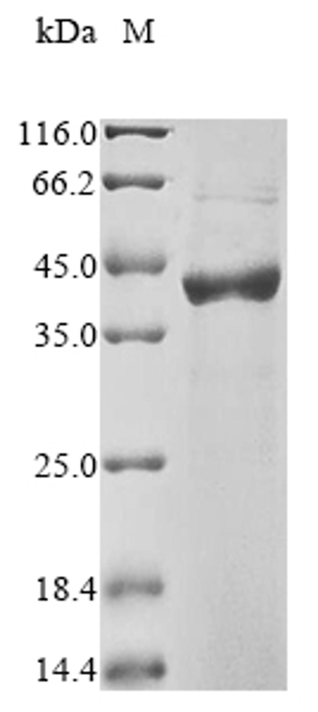 (Tris-Glycine gel) Discontinuous SDS-PAGE (reduced) with 5% enrichment gel and 15% separation gel.