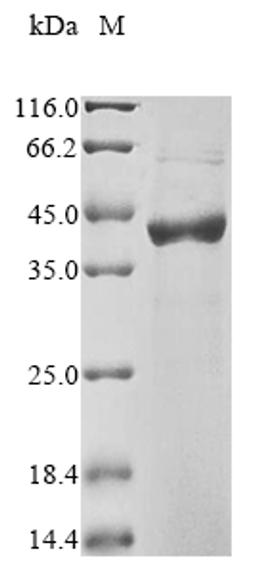 (Tris-Glycine gel) Discontinuous SDS-PAGE (reduced) with 5% enrichment gel and 15% separation gel.