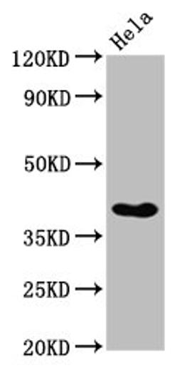 Western Blot. Positive WB detected in: Hela whole cell lysate. All lanes: NKX2-3 antibody at 3.8µg/ml. Secondary. Goat polyclonal to rabbit IgG at 1/50000 dilution. Predicted band size: 39 kDa. Observed band size: 39 kDa