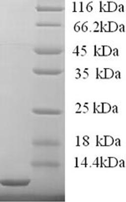 (Tris-Glycine gel) Discontinuous SDS-PAGE (reduced) with 5% enrichment gel and 15% separation gel.