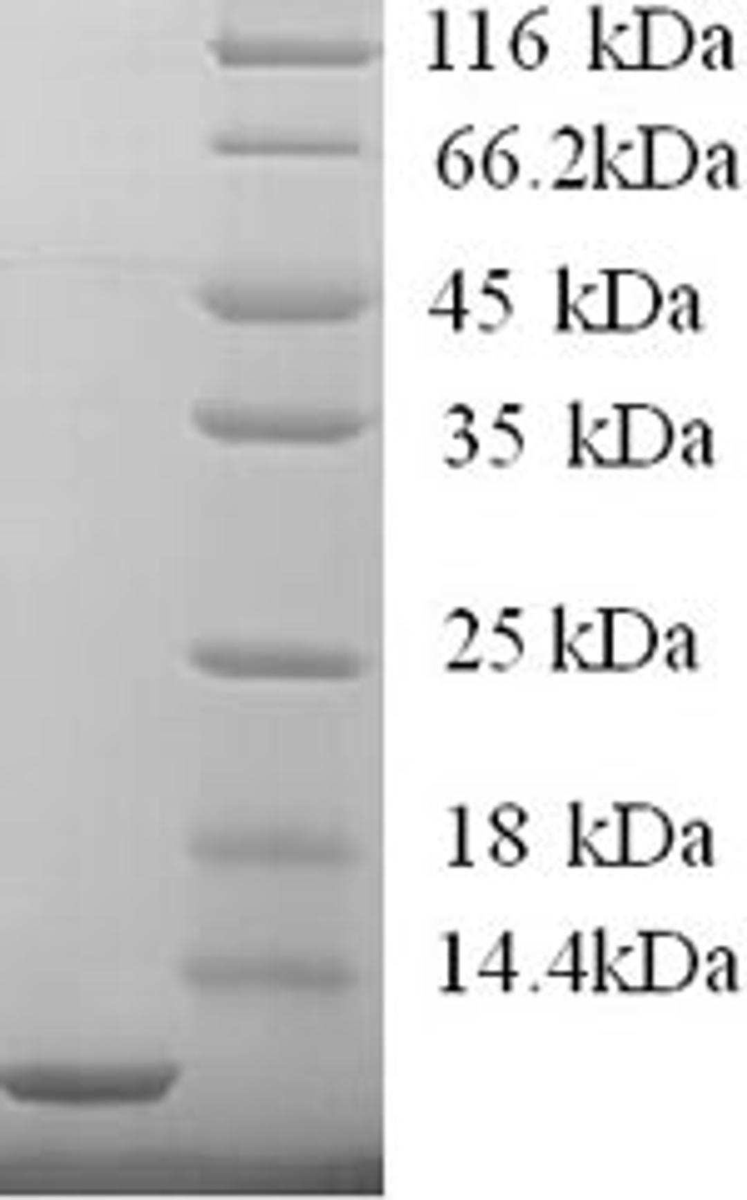 (Tris-Glycine gel) Discontinuous SDS-PAGE (reduced) with 5% enrichment gel and 15% separation gel.