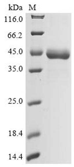 (Tris-Glycine gel) Discontinuous SDS-PAGE (reduced) with 5% enrichment gel and 15% separation gel.