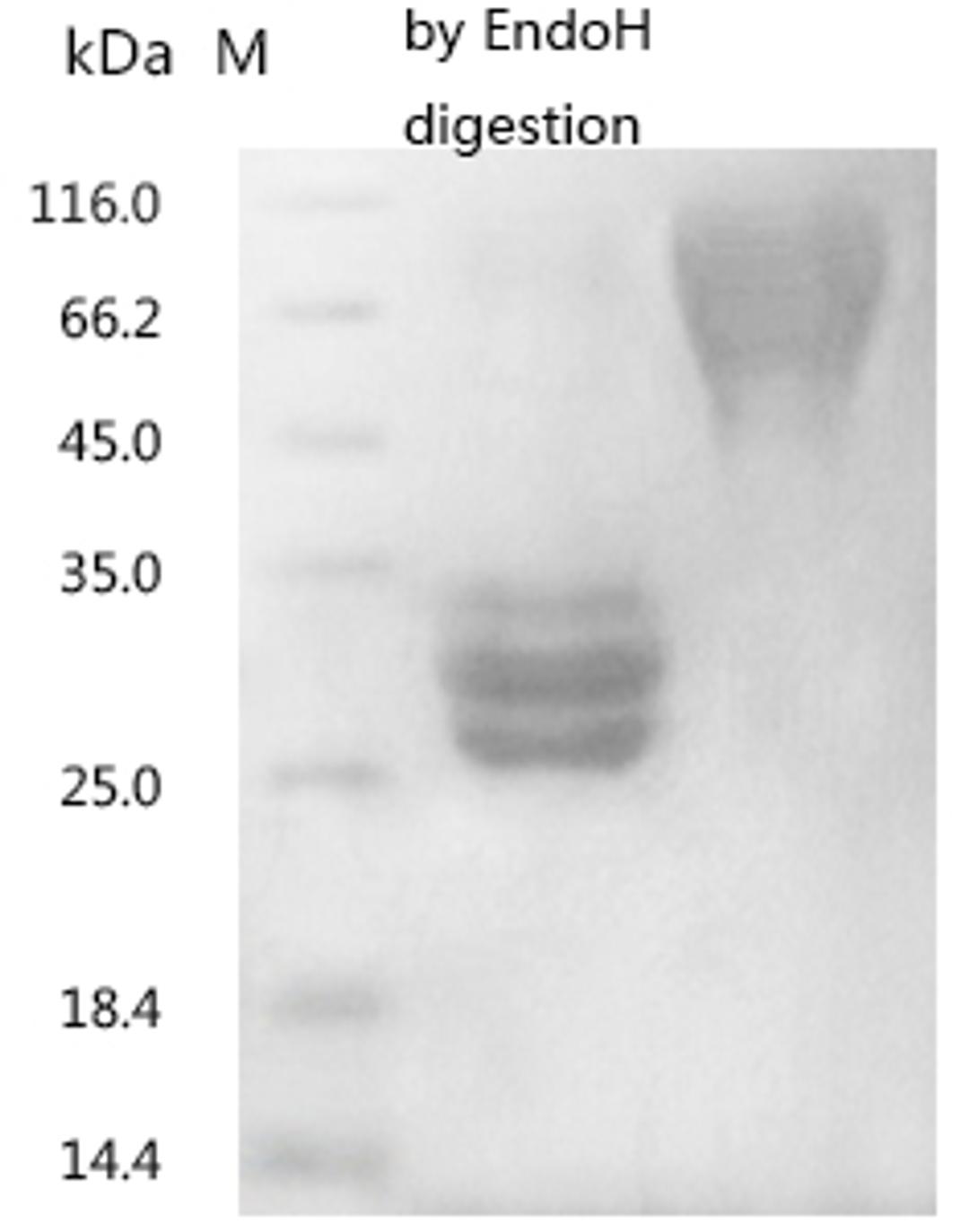(Tris-Glycine gel) Discontinuous SDS-PAGE (reduced) with 5% enrichment gel and 15% separation gel.