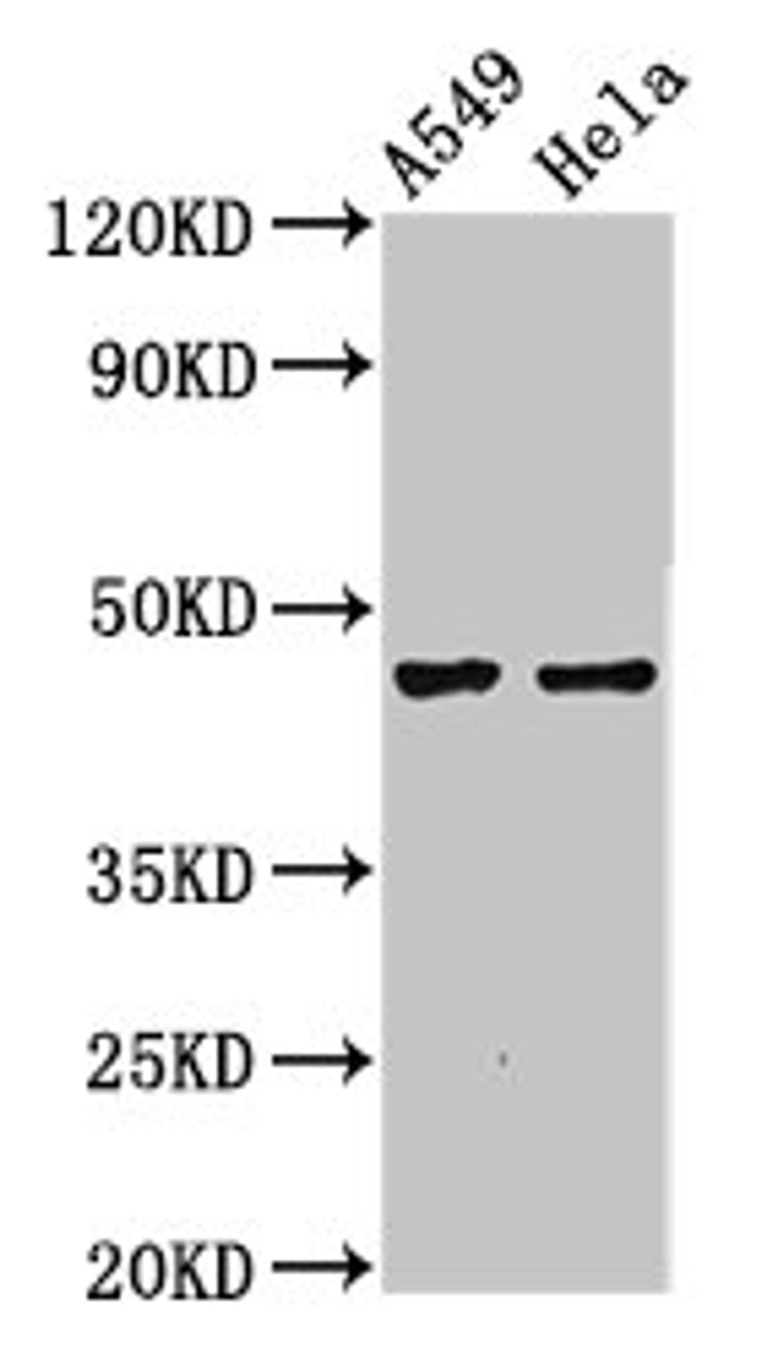 Western Blot. Positive WB detected in: A549 whole cell lysate, Hela whole cell lysate. All lanes: NMBR antibody at 4.4µg/ml. Secondary. Goat polyclonal to rabbit IgG at 1/50000 dilution. Predicted band size: 44 kDa. Observed band size: 44 kDa