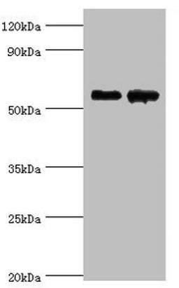 Western blot. All lanes: Beta-Ala-His dipeptidase antibody at 4ug/ml. Lane 1: 293T whole cell lysate. Lane 2: Hela whole cell lysate. Secondary. Goat polyclonal to rabbit IgG at 1/10000 dilution. Predicted band size: 57 kDa. Observed band size: 57 kDa. 