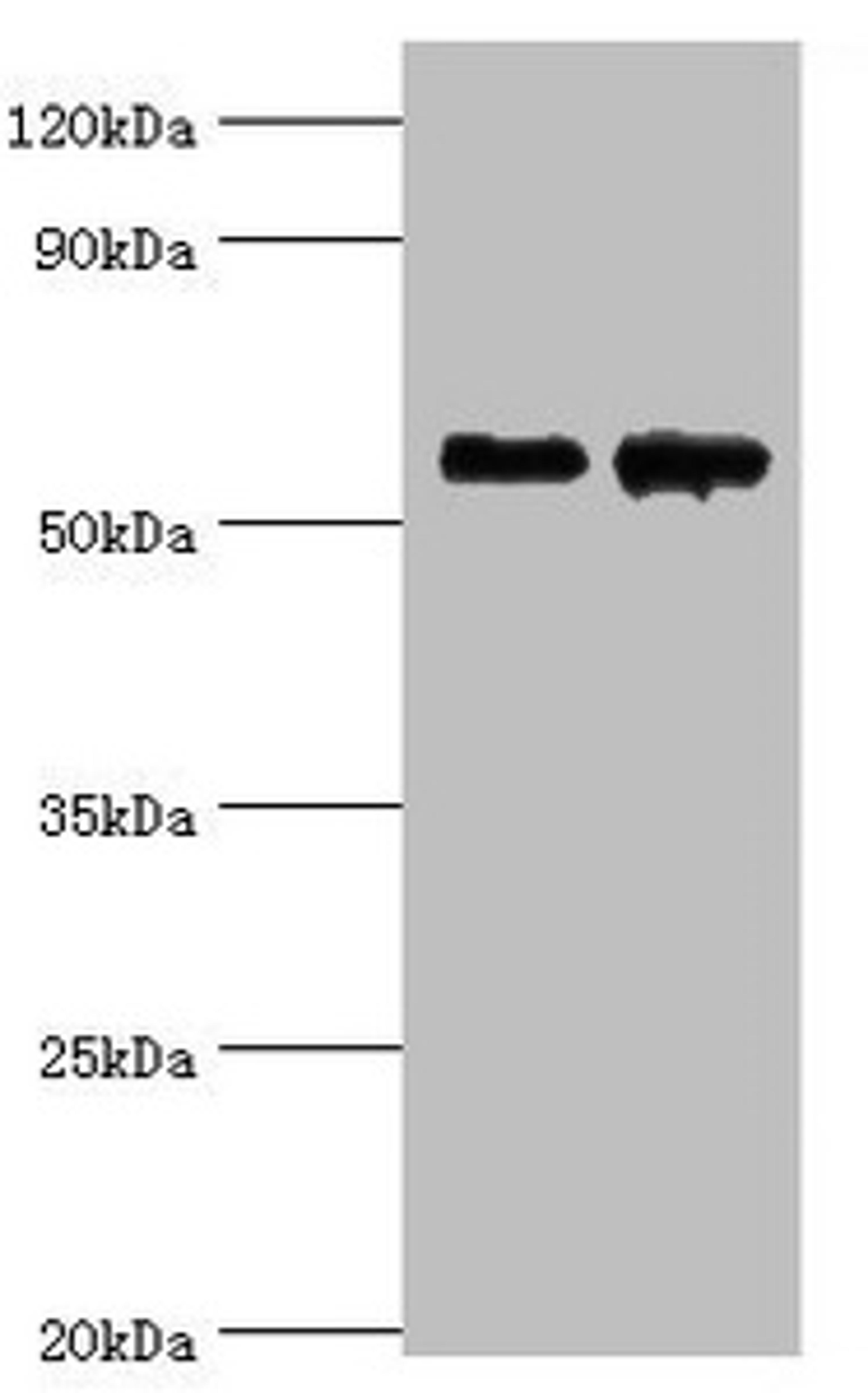 Western blot. All lanes: Beta-Ala-His dipeptidase antibody at 4ug/ml. Lane 1: 293T whole cell lysate. Lane 2: Hela whole cell lysate. Secondary. Goat polyclonal to rabbit IgG at 1/10000 dilution. Predicted band size: 57 kDa. Observed band size: 57 kDa. 